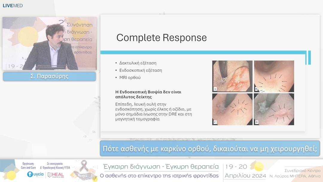 28 Σ. Παρασύρης - Πότε ασθενής με καρκίνο ορθού, δικαιούται να μη χειρουργηθεί; 