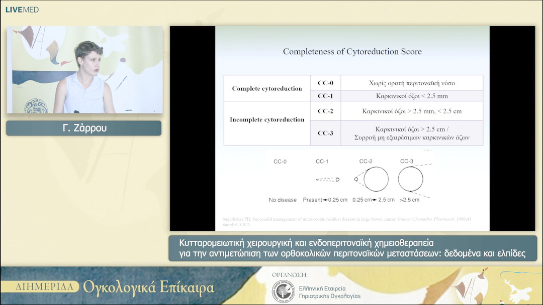 36 Γ. Ζάρρου - Κυτταρομειωτική χειρουργική και ενδοπεριτοναϊκή χημειοθεραπεία για την αντιμετώπιση των ορθοκολικών περιτοναϊκών μεταστάσεων: δεδομένα και ελπίδες 