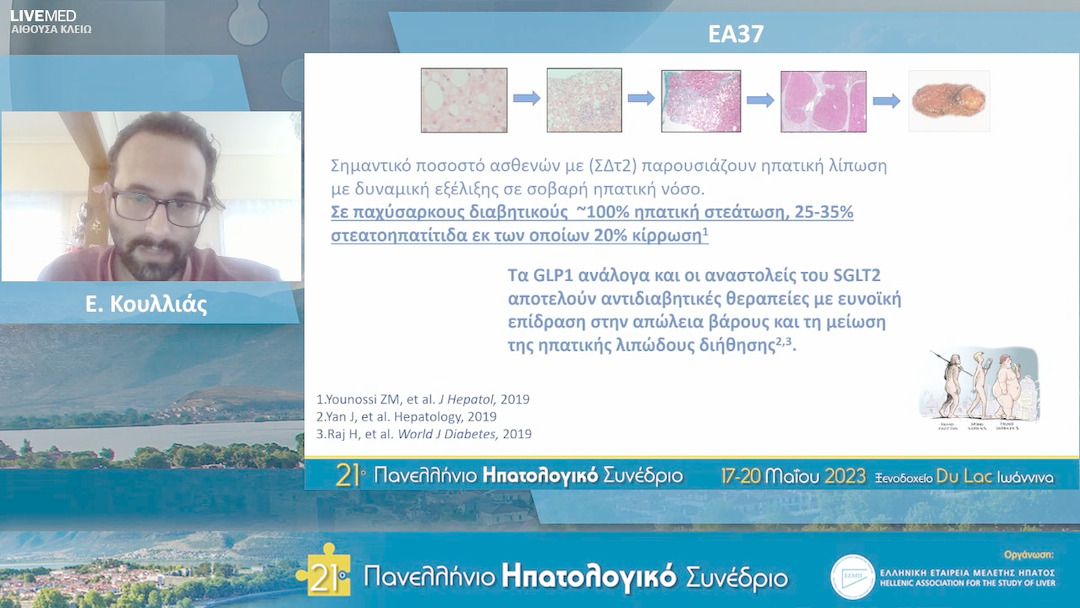22 Ε. Κουλλιάς - ΕΑ37: Νεότερα αντιδιαβητικά φάρμακα και ηπατική στεάτωση - ανάλυση παραγόντων συσχετιζόμενωνμε ανταπόκριση της νόσου.