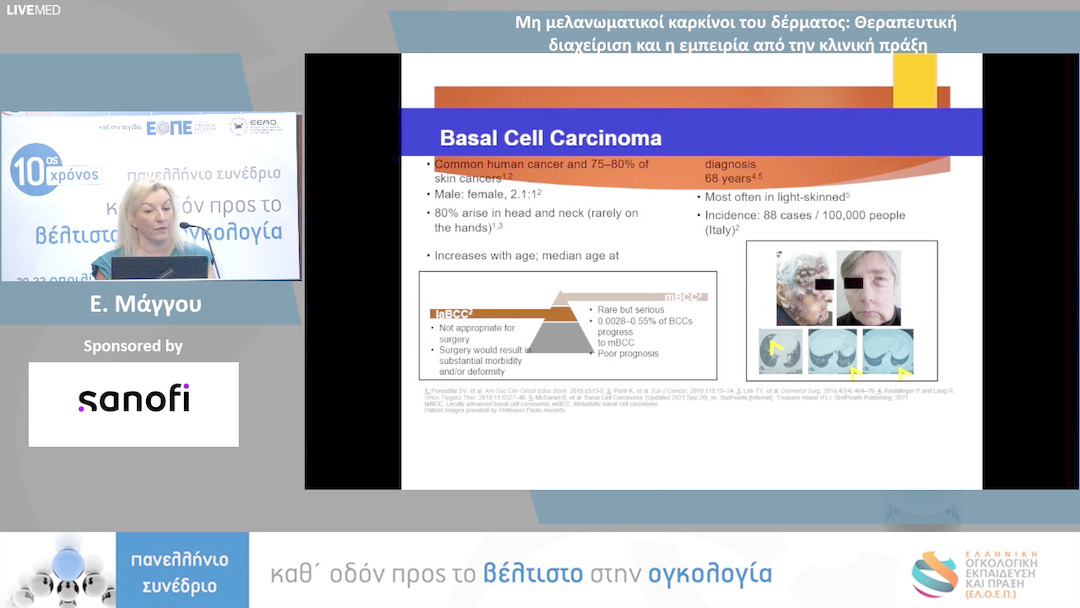 54 Ε. Μάγγου - Μη μελανωματικοί καρκίνοι του δέρματος: Θεραπευτική διαχείριση και η εμπειρία από την κλινική πράξη