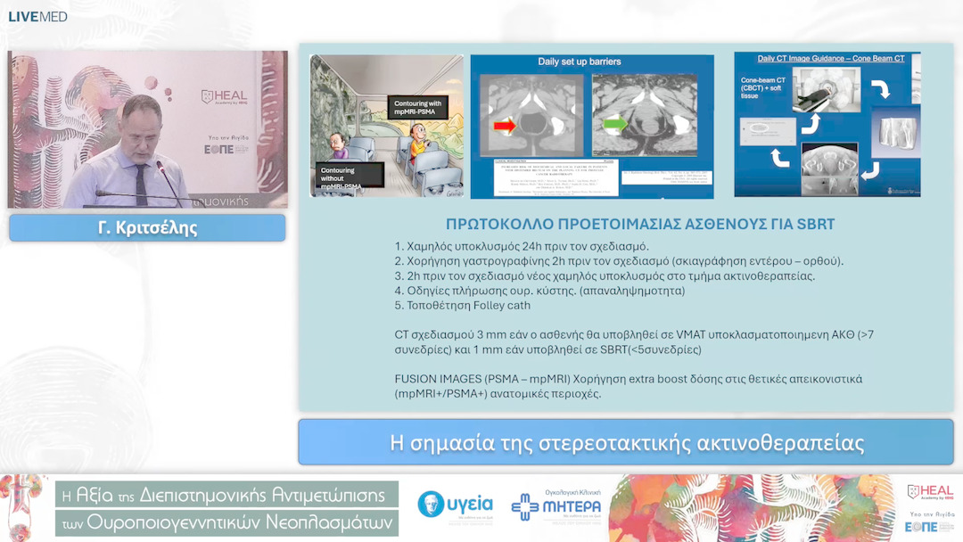 14 Γ. Κριτσέλης - Η σημασία της στερεοτακτικής ακτινοθεραπείας 