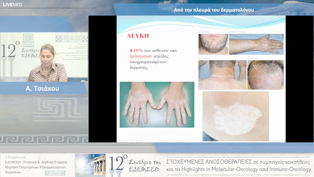 34  Α. Τσιάκου - Από την πλευρά του δερματολόγου