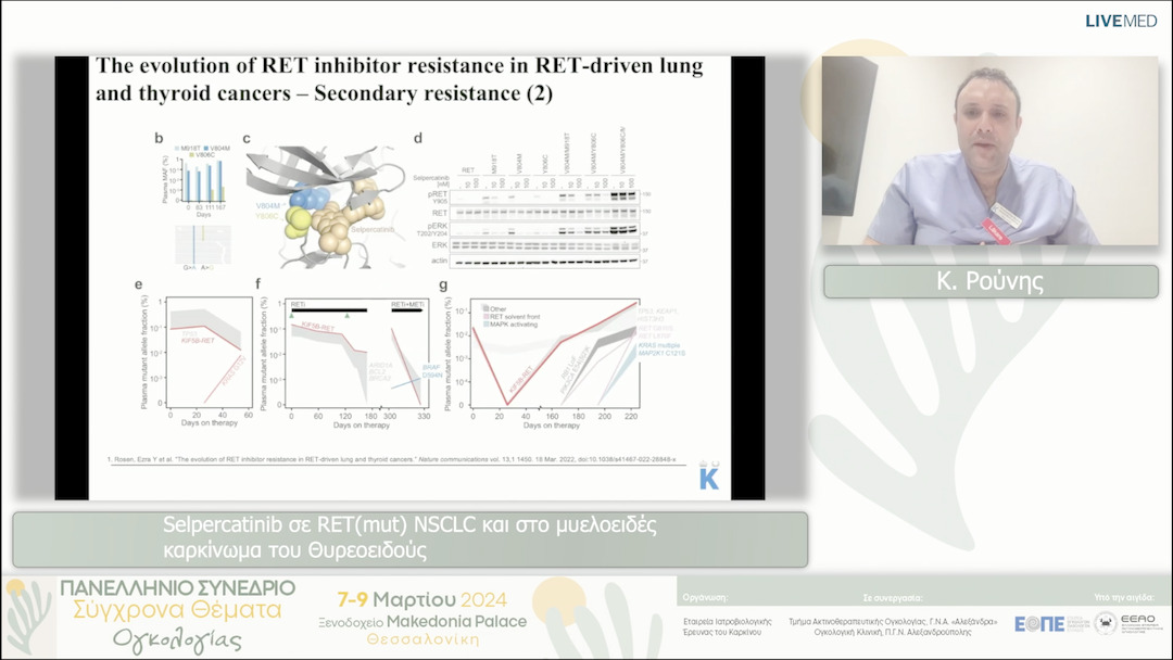 21 Κ. Ρούνης - Selpercatinib σε RET(mut) NSCLC και στο μυελοειδές καρκίνωμα του Θυρεοειδούς 
