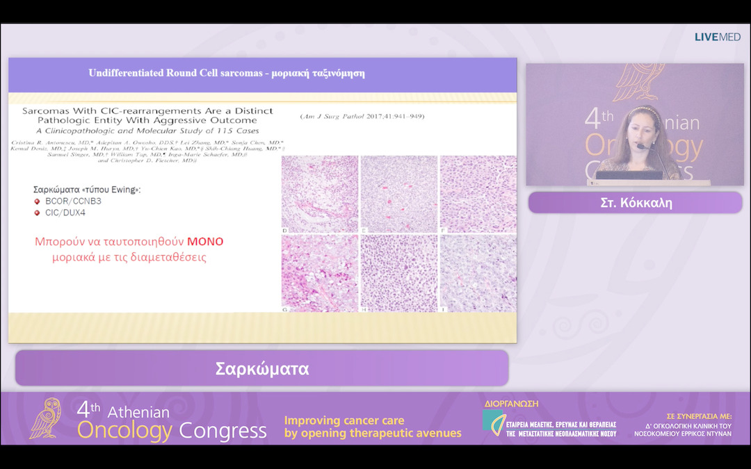 43  Στ. Κόκκαλη - Σαρκώματα