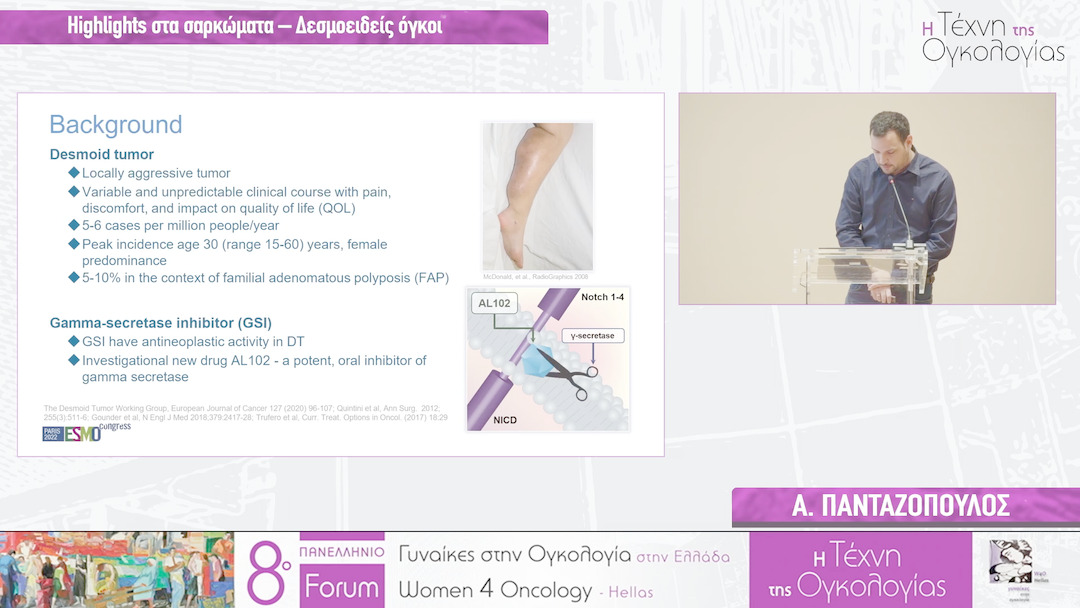 21 Α. Πανταζόπουλος - Highlights στα σαρκώματα – Δεσμοειδείς όγκοι 