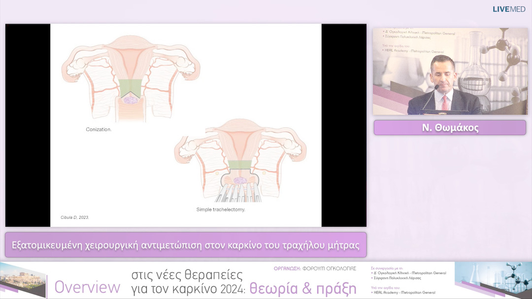 38 Ν. Θωμάκος - Εξατομικευμένη χειρουργική αντιμετώπιση στον καρκίνο του τραχήλου μήτρας 