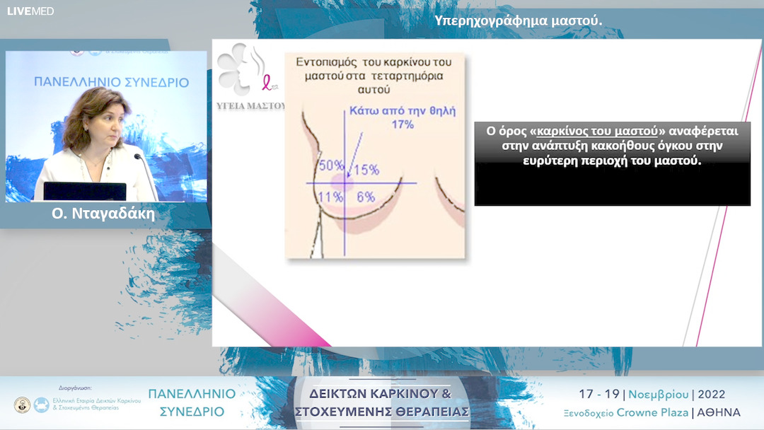 23  Ο. Νταγαδάκη - Υπερηχογράφημα μαστού.