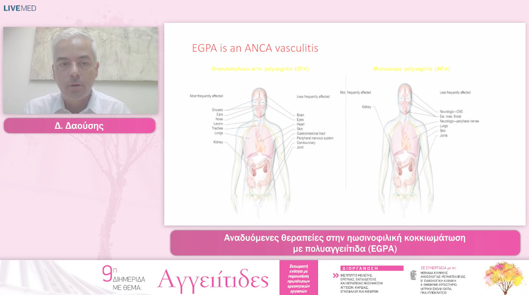 48 δ. δαούσης - Αναδυόμενες θεραπείες στην ηωσινοφιλική κοκκιωμάτωση με πολυαγγειίτιδα (EGPA) 