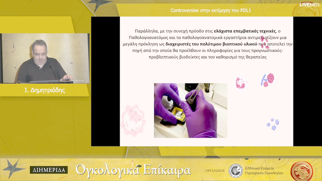 28  Ι. Δημητριάδης- Controversies στην εκτίμηση του PDL1