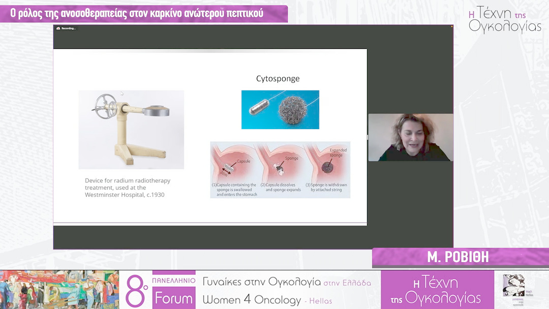 33 Μ. Ροβίθη - Ο ρόλος της ανοσοθεραπείας στον καρκίνο ανώτερου πεπτικού
