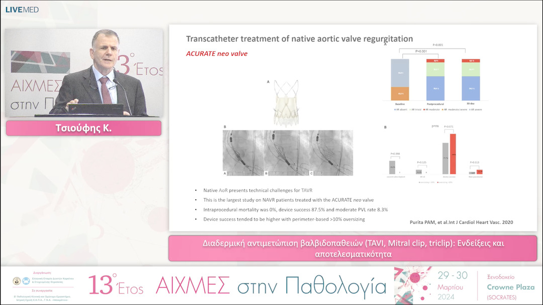 29 Τσιούφης Κ. - Διαδερμική αντιμετώπιση βαλβιδοπαθειών (TAVI, Mitral clip, triclip): Ενδείξεις και αποτελεσματικότητα. 