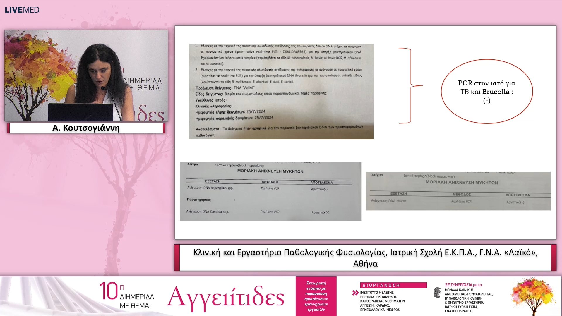 36 Α. Κουτσογιάννη, Α. Γουλές - ΠΑΡΟΥΣΙΑΣΗ ΣΥΖΗΤΗΣΗ ΠΕΡΙΠΤΩΣΕΩΝ ΑΣΘΕΝΩΝ ΜΕ ΑΓΓΕΙΙΤΙΔΕΣ