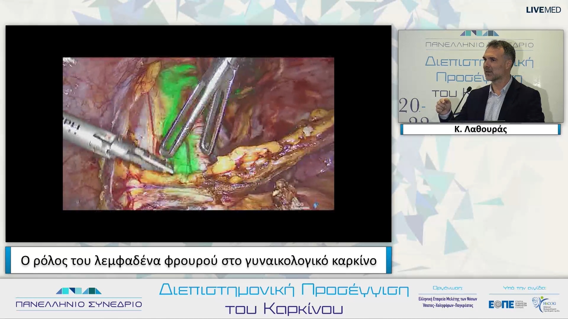 16 Κ. Λαθουράς - Ο ρόλος του λεμφαδένα φρουρού στο γυναικολογικό καρκίνο. 