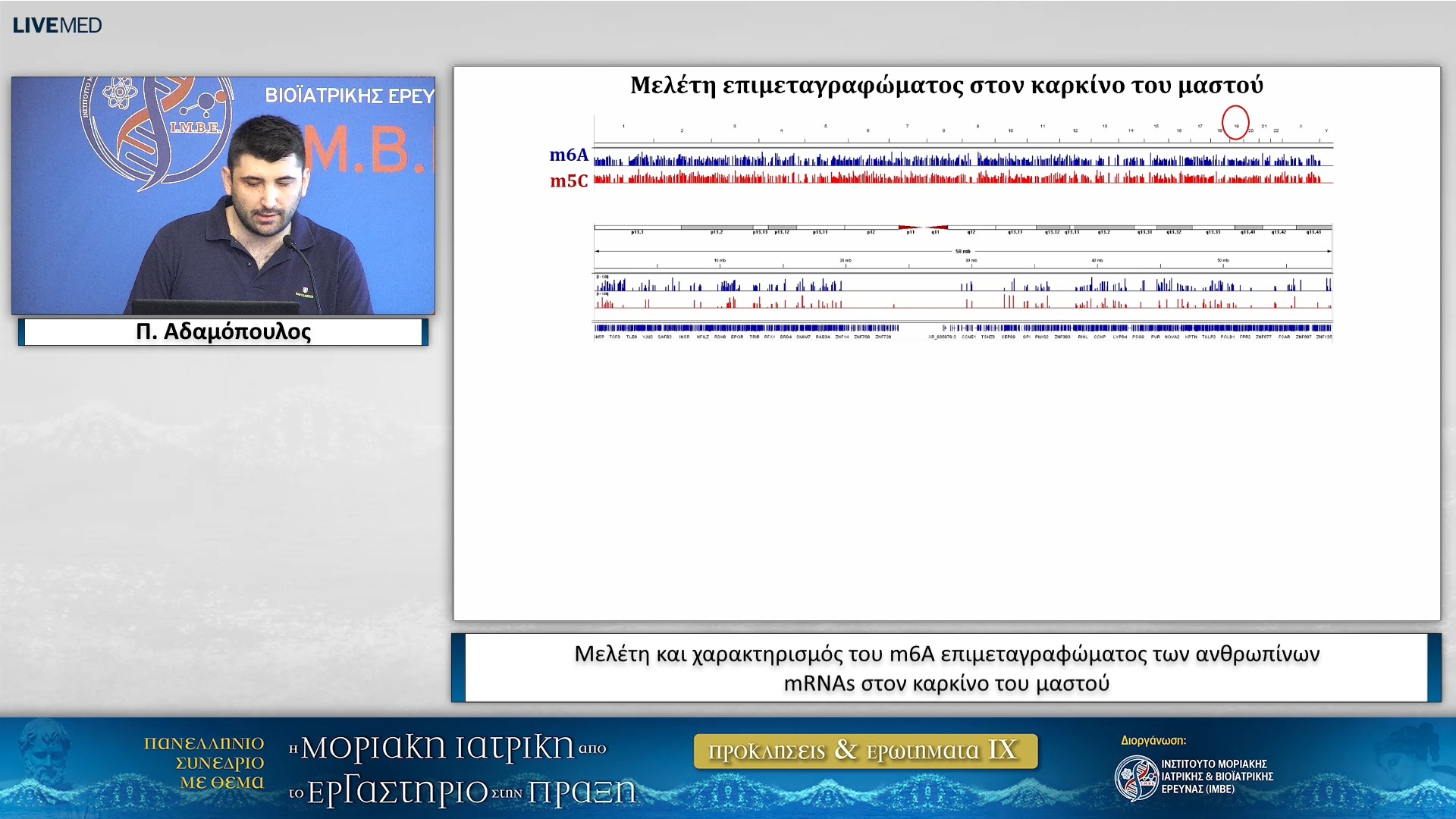12  Π. Αδαμόπουλος - Μελέτη και χαρακτηρισμός του m6A επιμεταγραφώματος των ανθρωπίνων mRNAs στον καρκίνο του μαστού