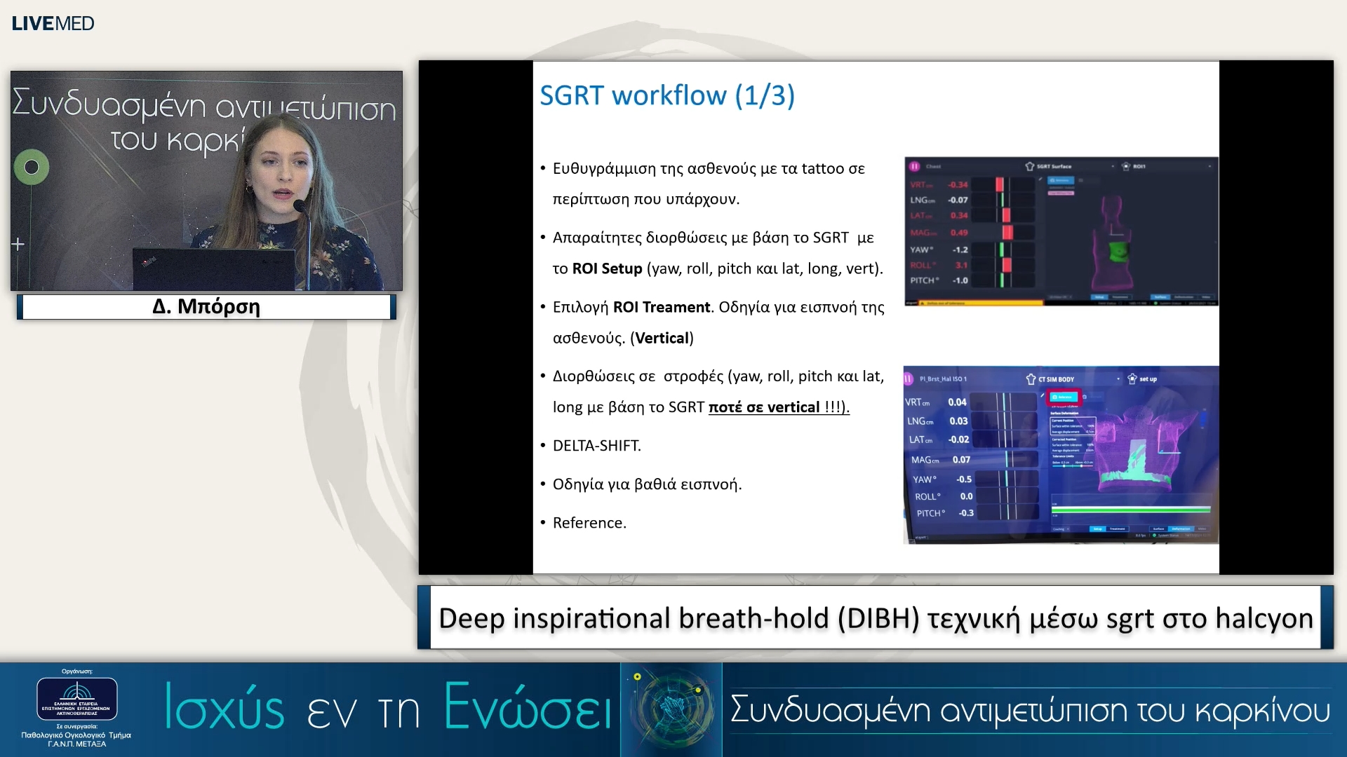27 Δ. Μπόρση - Deep inspirational breath-hold (DIBH) τεχνική μέσω sgrt στο halcyon