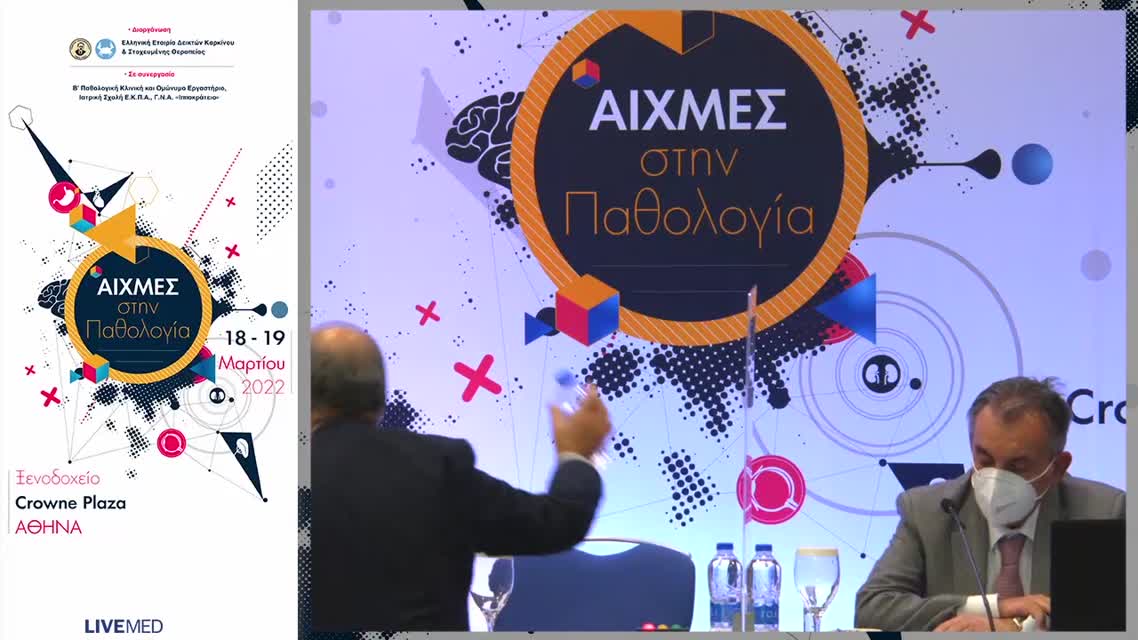 45 Σ. Κόκκαλη - Ο συνδυασμός της αντι-αγγειογένεσης με την ανοσοθεραπεία στην πρώτη γραμμή συστηματικής θεραπείας του προχωρημένου ΗΚΚ: παρουσίαση περιστατικών Παρουσίαση περιστατικών