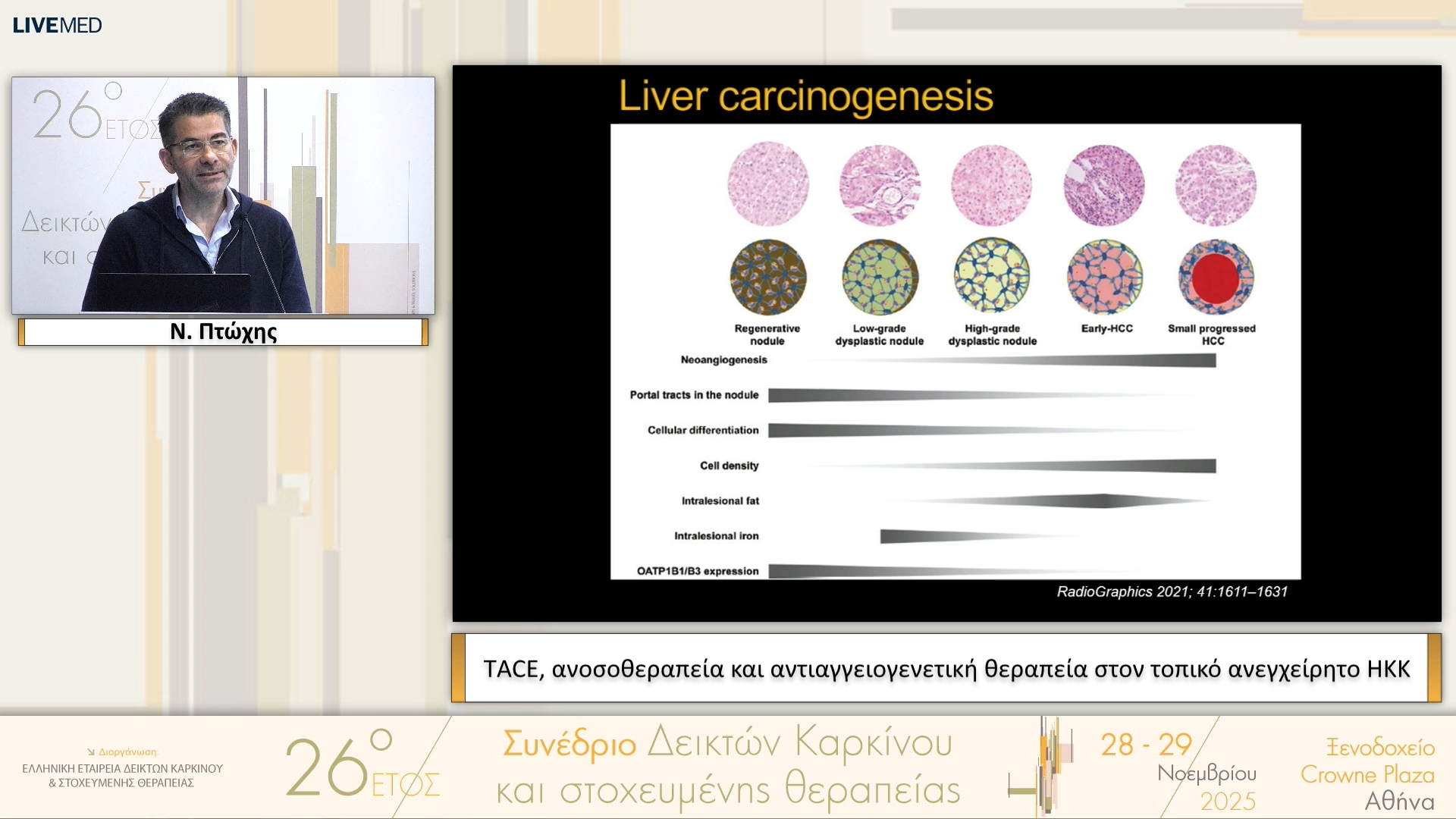 41 Ν. Πτώχης - ΤACE, ανοσοθεραπεία και αντιαγγειογενετική θεραπεία στον τοπικό ανεγχείρητο ΗΚΚ 