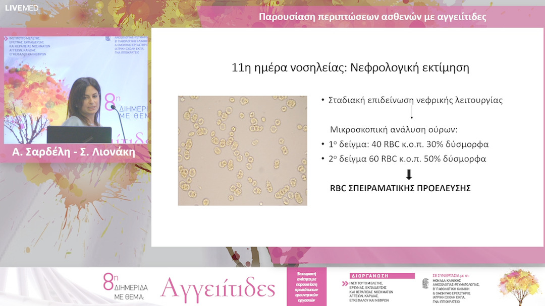25 Α. Σαρδέλη - Σ. Λιονάκη - Παρουσίαση περιπτώσεων ασθενών με αγγειίτιδες