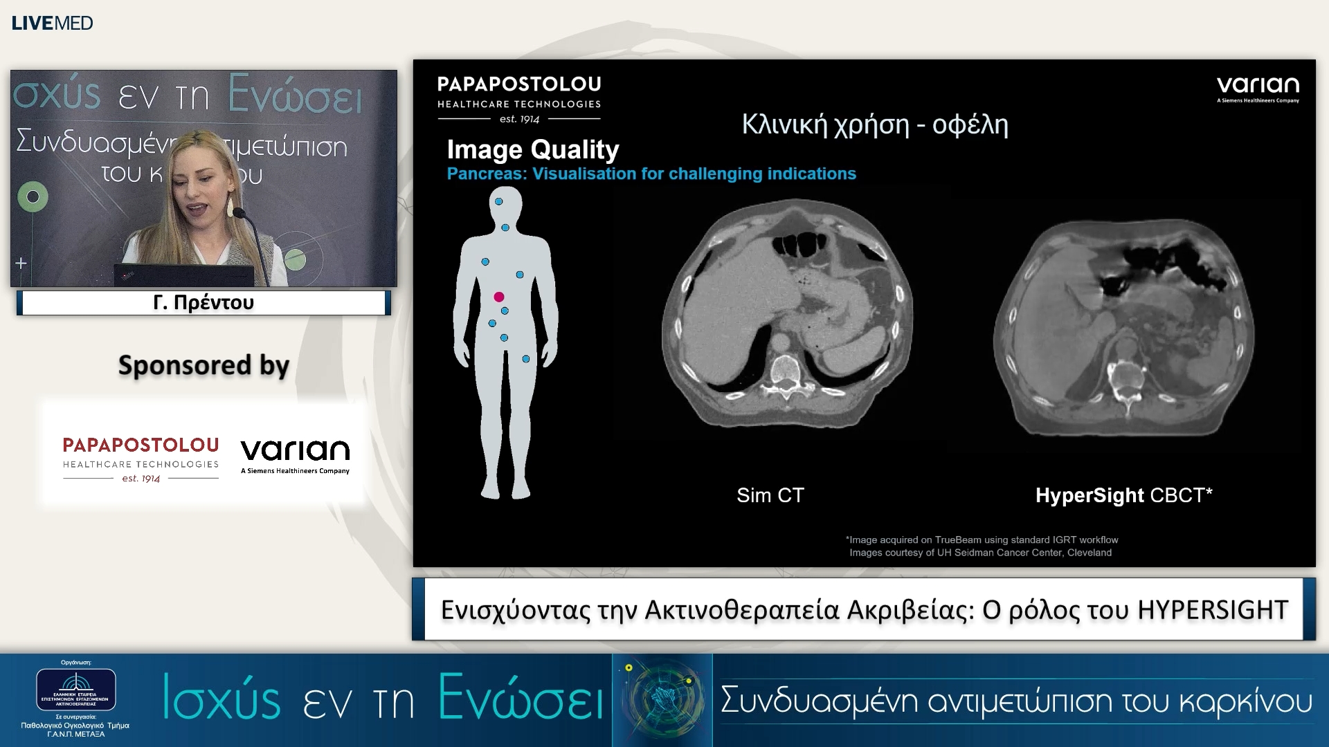41 Γ. Πρέντου - Ενισχύοντας την Ακτινοθεραπεία Ακριβείας: Ο ρόλος του HYPERSIGHT