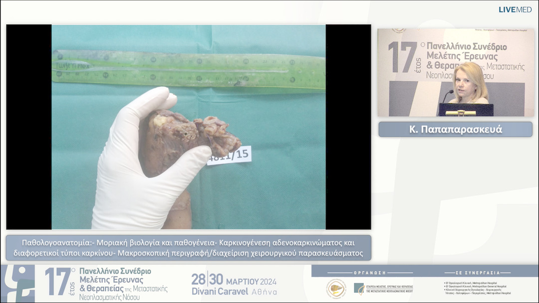 23 Κ. Παπαπαρασκευά - - Μοριακή βιολογία και παθογένεια  - Καρκινογένεση αδενοκαρκινώματος και διαφορετικοί τύποι καρκίνου  - Μακροσκοπική περιγραφή/διαχείριση χειρουργικού παρασκευάσματος 