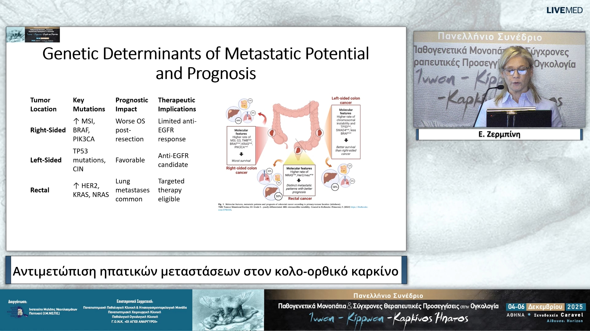 23 Ε. Ζερμπίνη - Αντιμετώπιση ηπατικών μεταστάσεων στον κολο-ορθικό καρκίνο