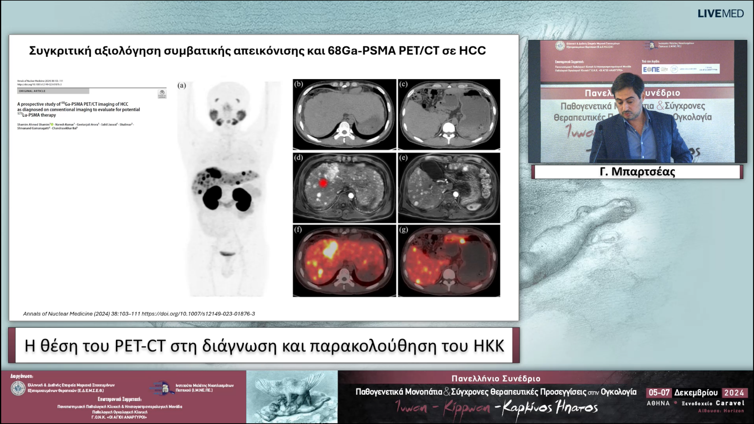 51 Γ. Μπαρτσέας - Η θέση του PET-CT στη διάγνωση και παρακολούθηση του ΗΚΚ