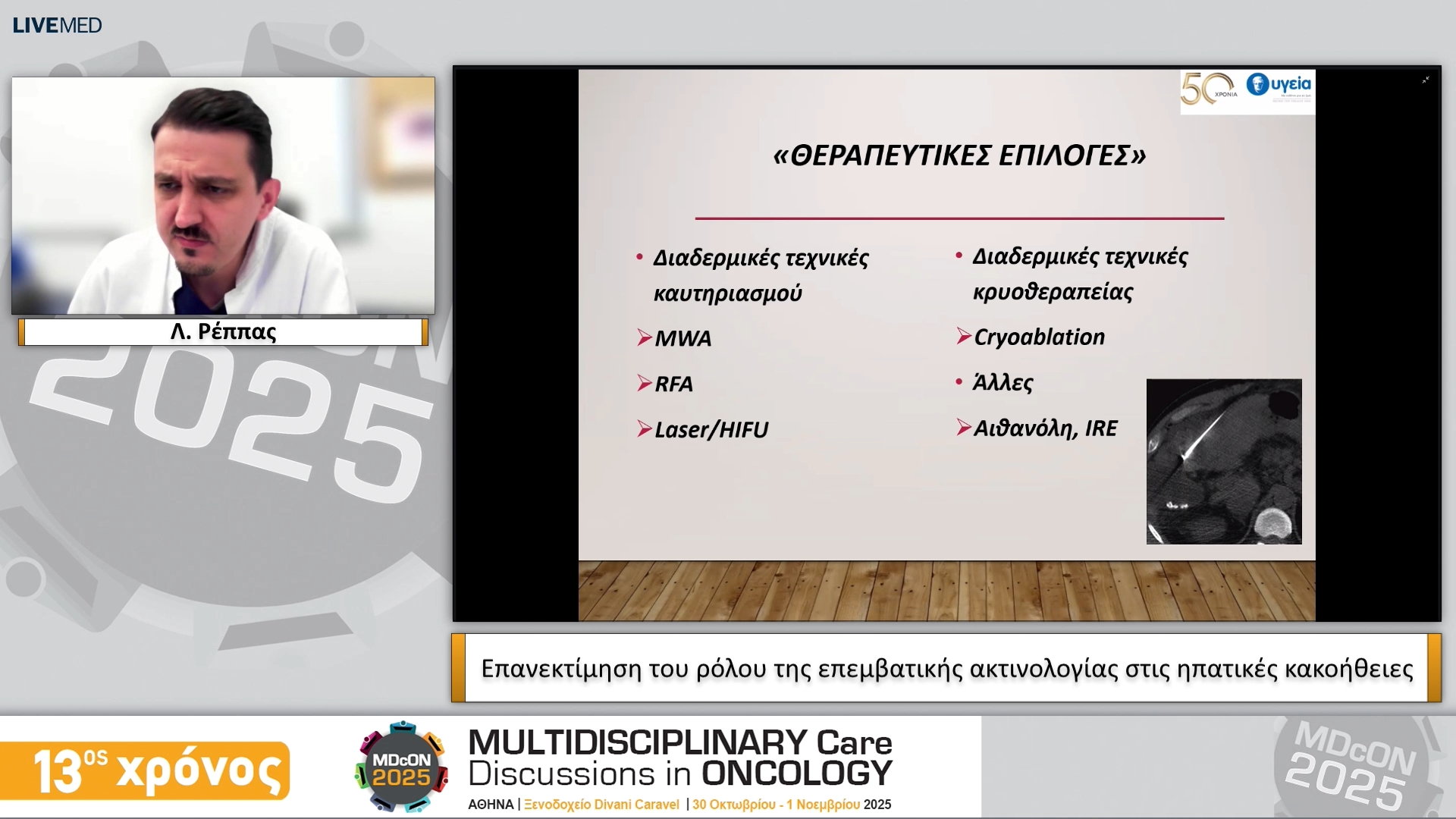 27 Λ. Ρέππας - Επανεκτίμηση του ρόλου της επεμβατικής ακτινολογίας στις ηπατικές κακοήθειες
