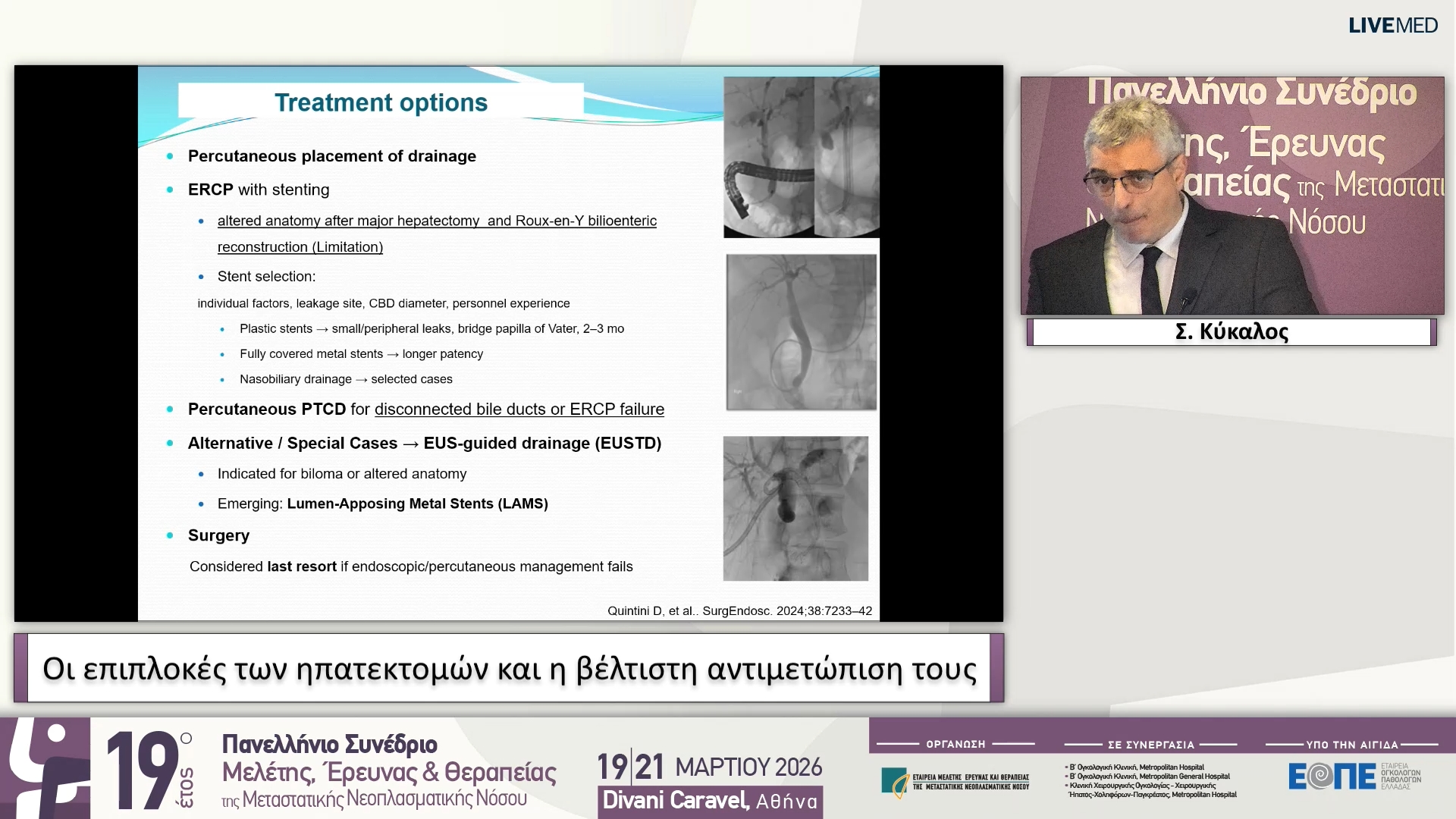 25 Σ. Κύκαλος - Οι επιπλοκές των ηπατεκτομών και η βέλτιστη αντιμετώπιση τους