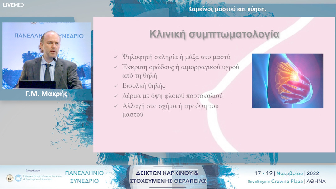 30 Γ.Μ. Μακρής - Καρκίνος μαστού και κύηση.