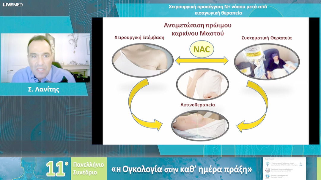 54 Σ. Λανίτης - Χειρουργική προσέγγιση Ν+ νόσου μετά από εισαγωγική θεραπεία 