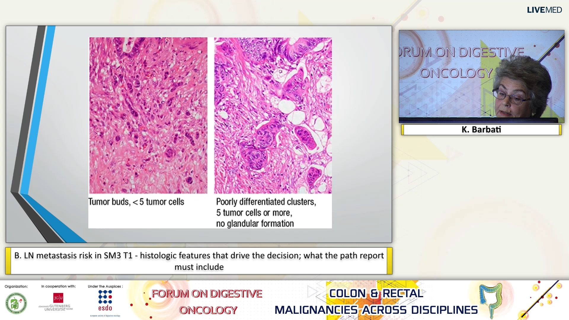 45 K. Barbati - B. LN metastasis risk in SM3 T1 - histologic features that drive the decision; what the path report must include.