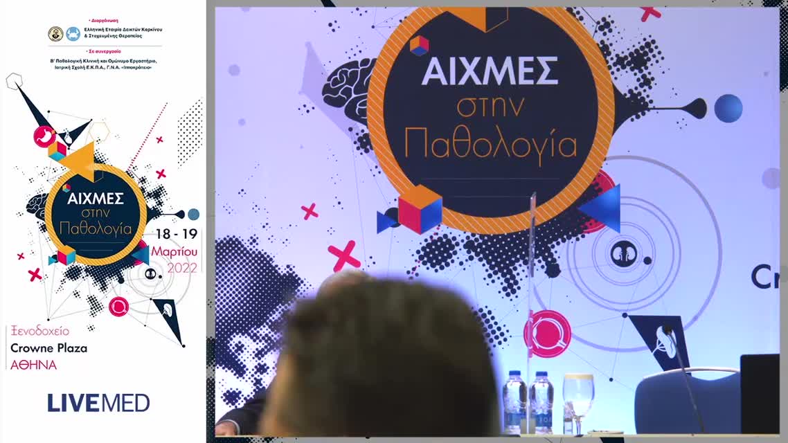 35 Ζιώγας Δ. - Θρόμβωση και Καρκίνος 