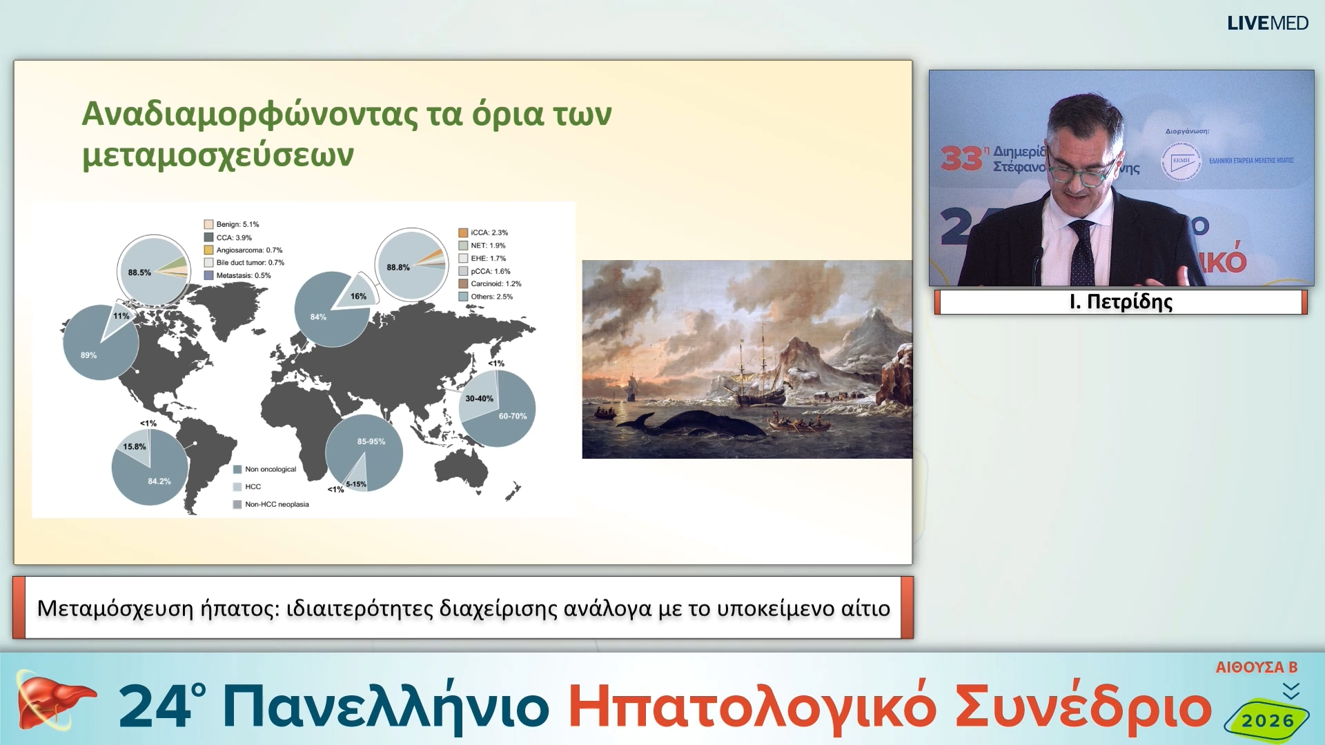 18 Ι. Πετρίδης - Μεταμόσχευση ήπατος: ιδιαιτερότητες διαχείρισης ανάλογα με το υποκείμενο αίτιο