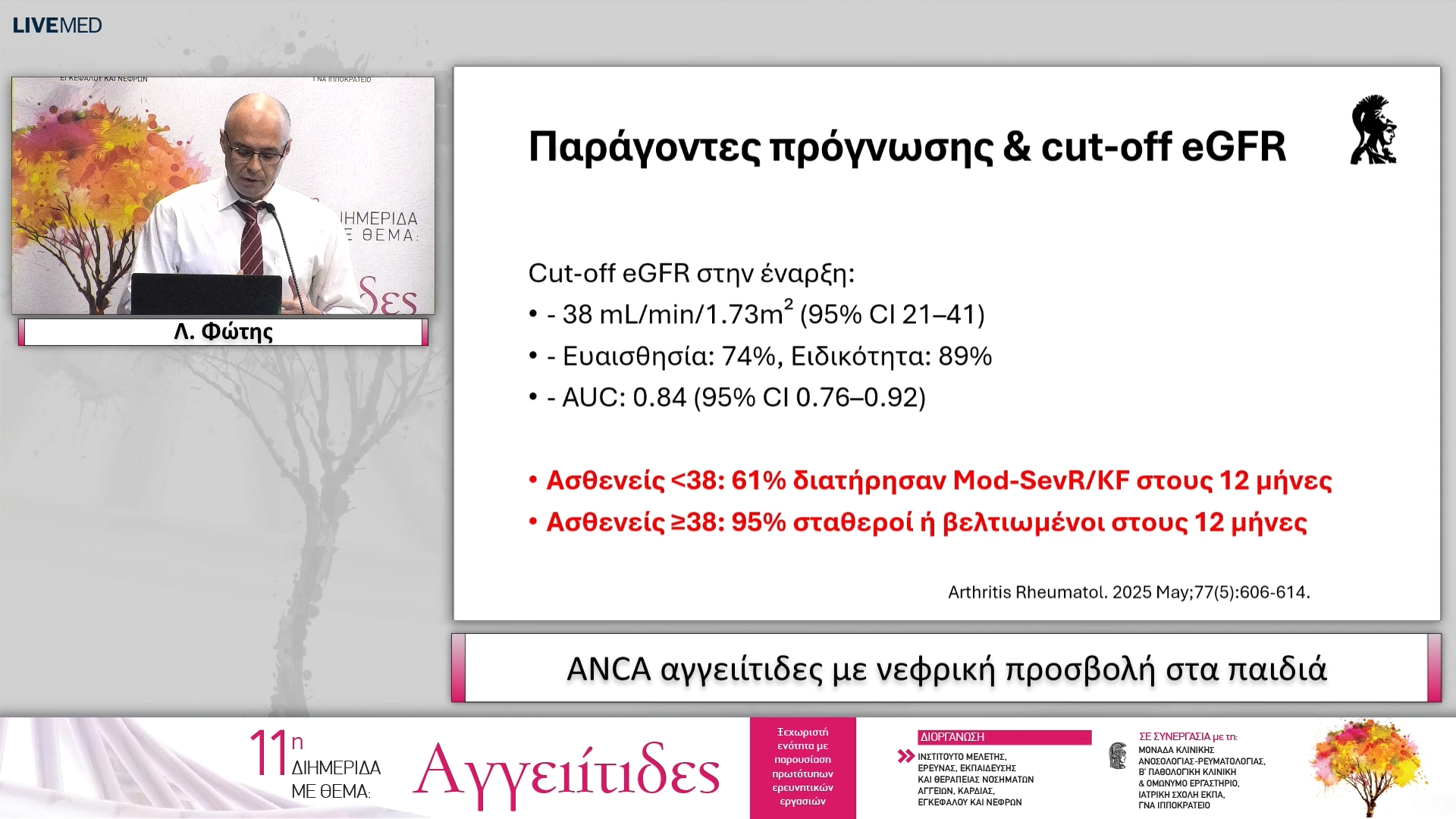 53 Λ. Φώτης - ANCA αγγειίτιδες με νεφρική προσβολή στα παιδιά