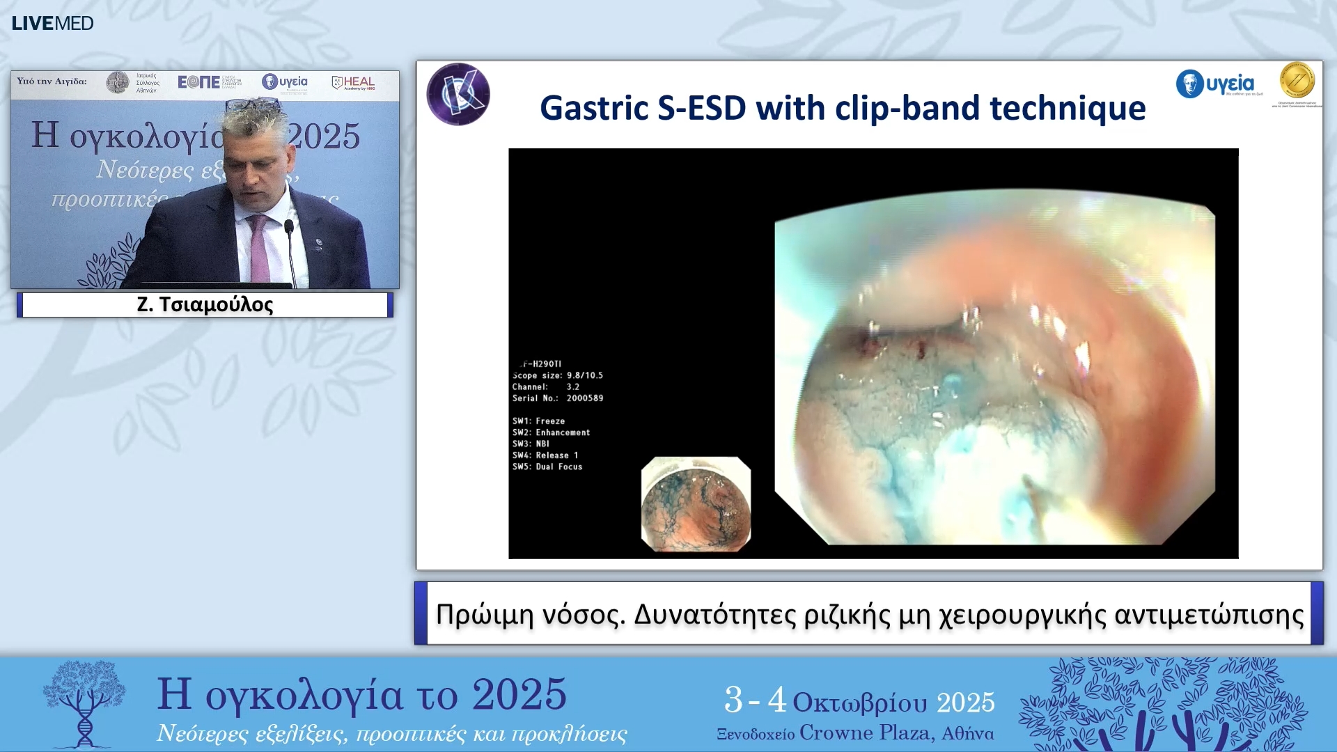 27 Ζ. Τσιαμούλος - Πρώιμη νόσος. Δυνατότητες ριζικής μη χειρουργικής αντιμετώπισης 