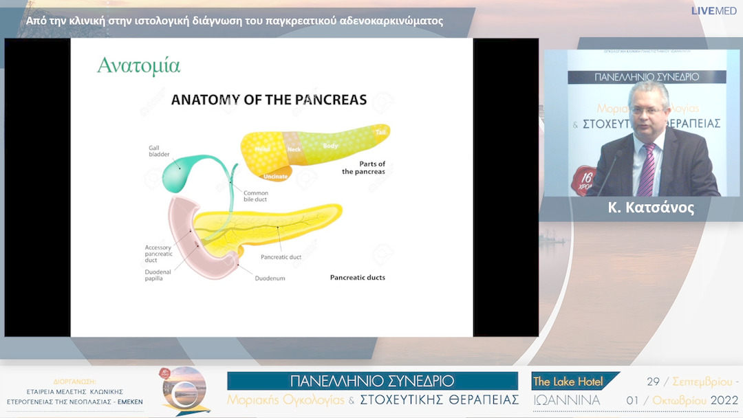 20 Κ. Κατσάνος - Από την κλινική στην ιστολογική διάγνωση του παγκρεατικού αδενοκαρκινώματος