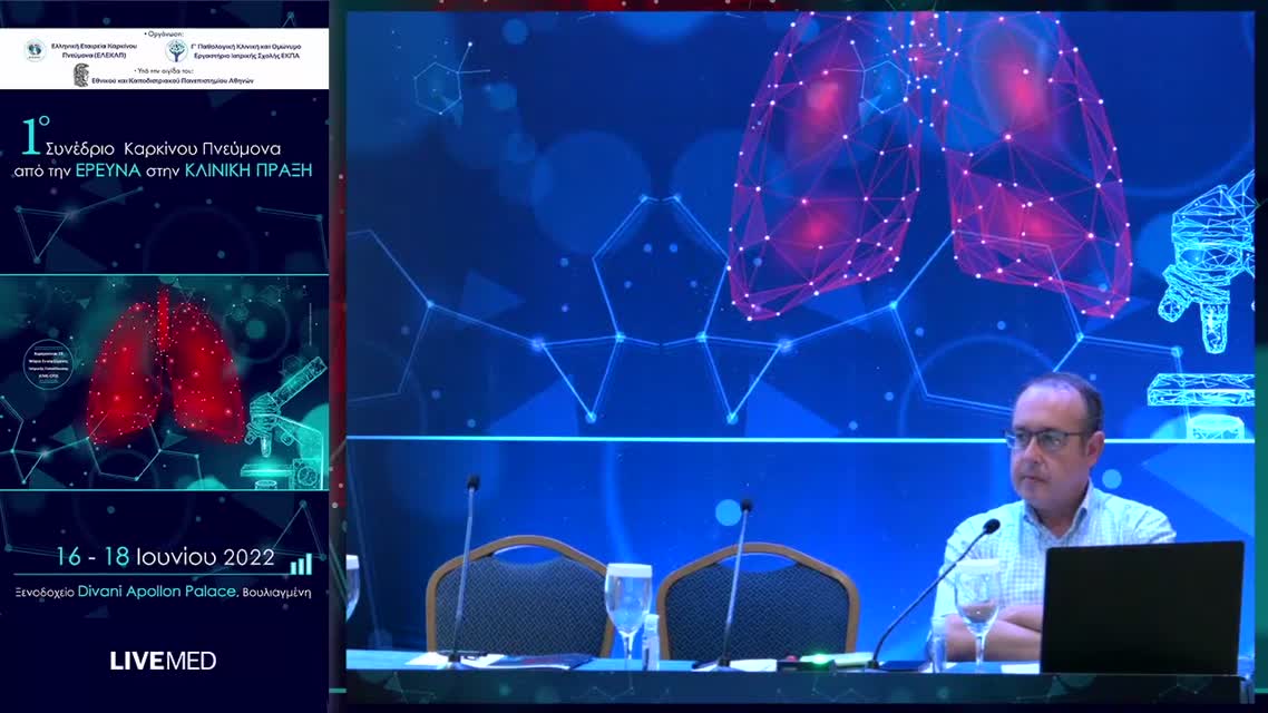 30 Σχολιασμός 