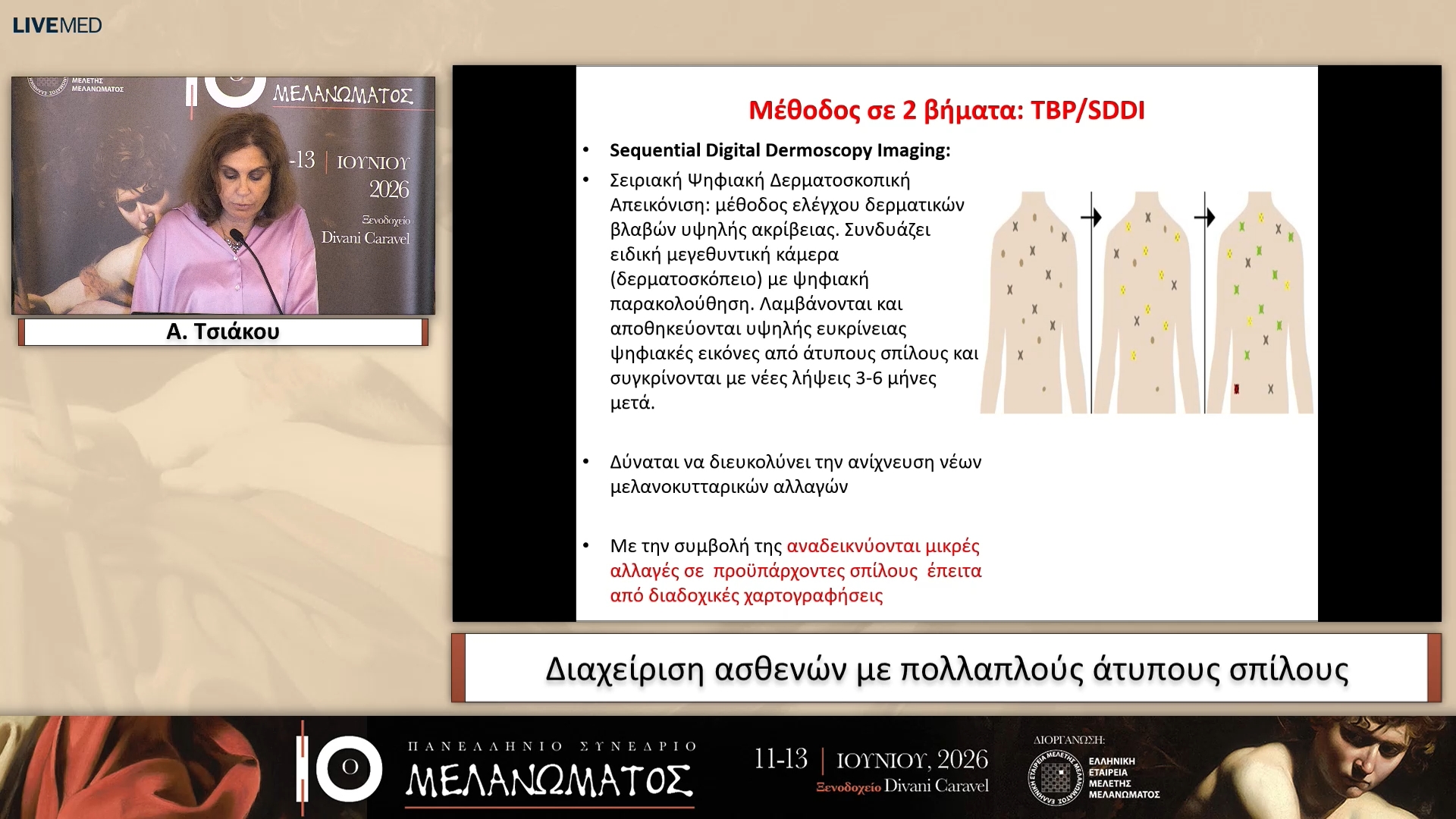 38 Α. Τσιάκου - Διαχείριση ασθενών με πολλαπλούς άτυπους σπίλους 