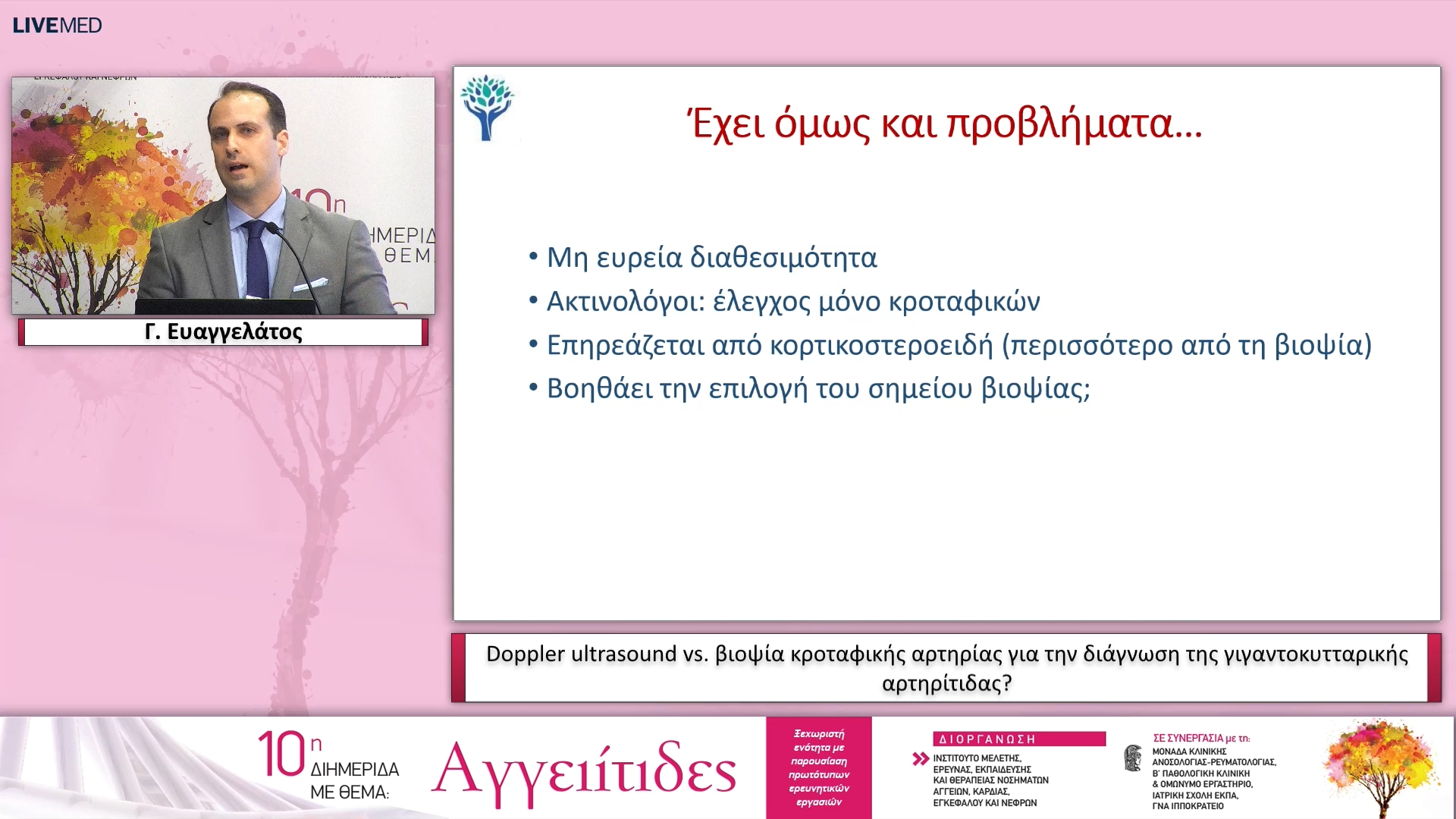 51 Γ. Ευαγγελάτος - Doppler ultrasound vs. βιοψία κροταφικής αρτηρίας για την διάγνωση της γιγαντοκυτταρικής αρτηρίτιδας? 