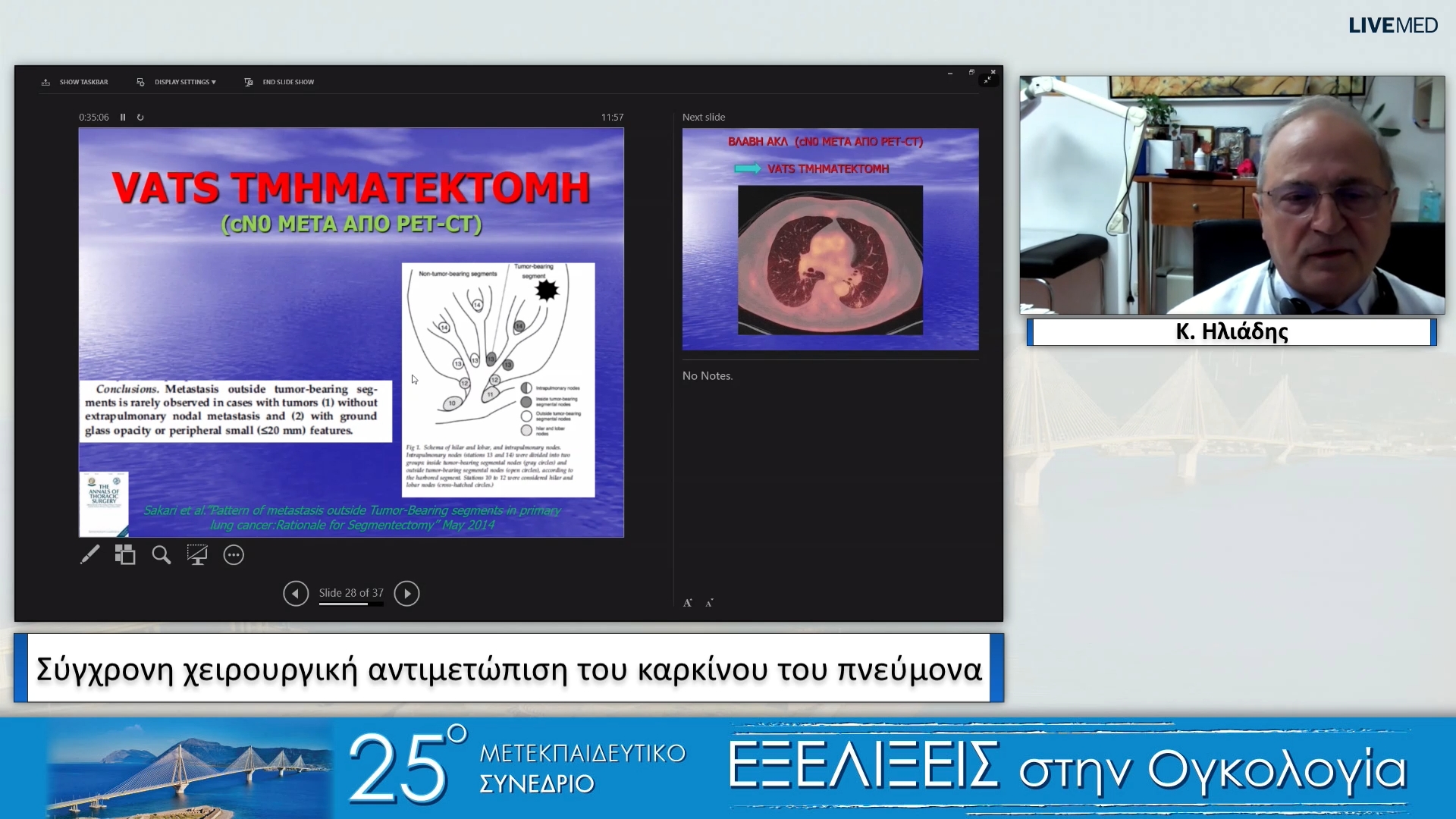 32 Κ. Ηλιάδης - Σύγχρονη χειρουργική αντιμετώπιση του καρκίνου του πνεύμονα