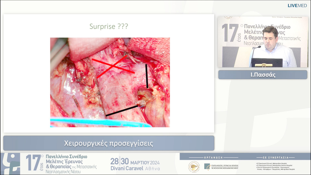 30 Ι.Πασσάς Χειρουργικές προσεγγίσεις