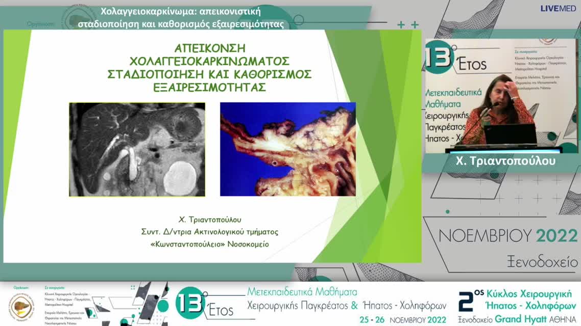 14 Χ. Τριαντοπούλου - Χολαγγειοκαρκίνωμα: απεικονιστική σταδιοποίηση και καθορισμός εξαιρεσιμότητας