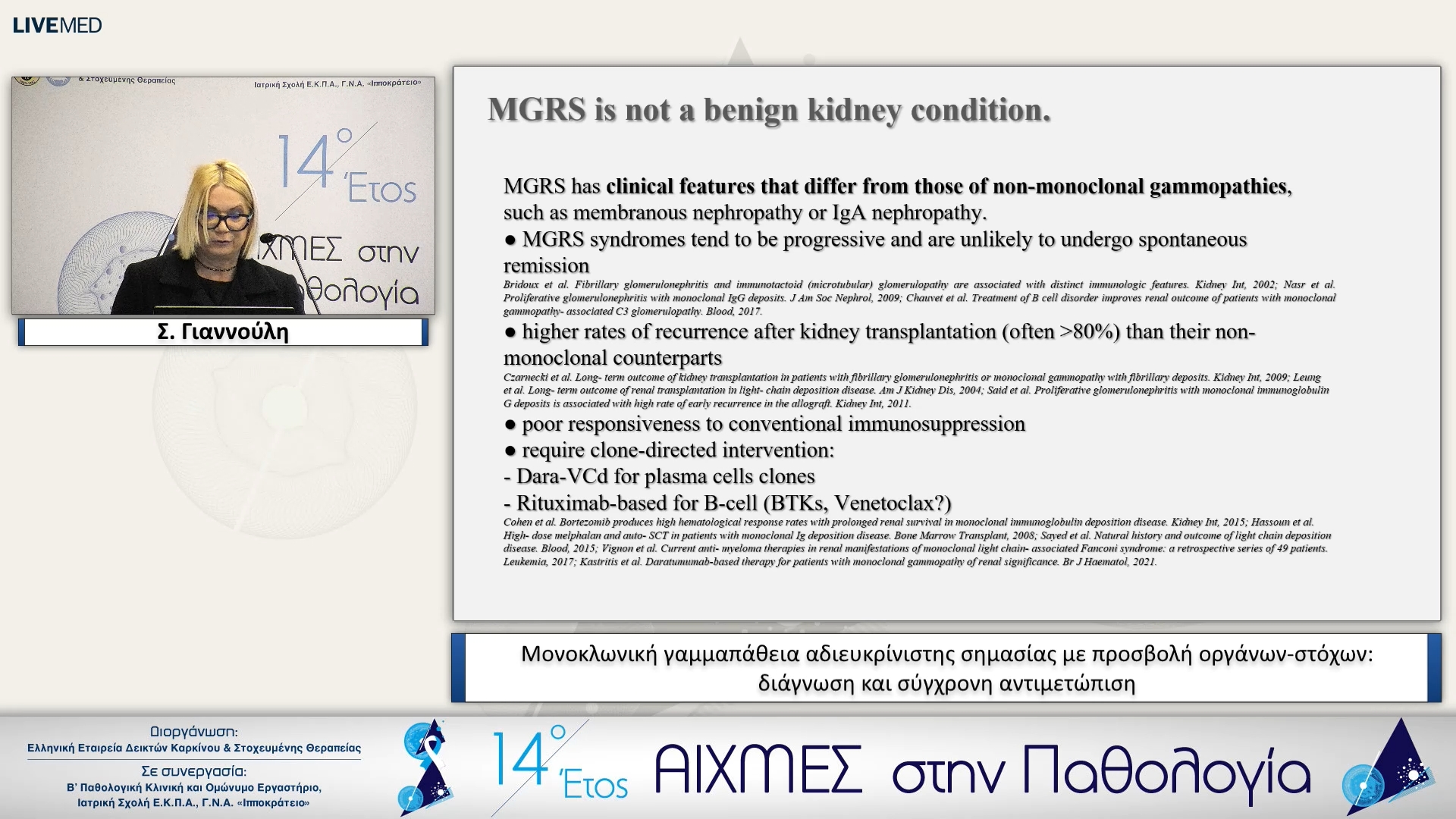 32 Σ. Γιαννούλη - Μονοκλωνική γαμμαπάθεια αδιευκρίνιστης σημασίας με προσβολή οργάνων-στόχων: διάγνωση και σύγχρονη αντιμετώπιση