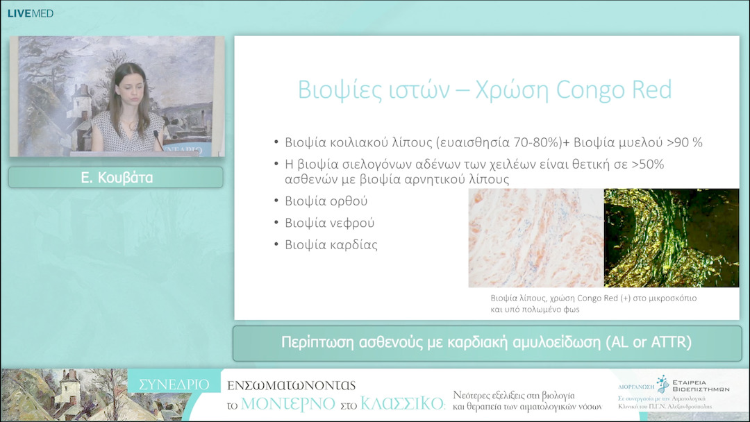 34 Ε. Κουβάτα - Περίπτωση ασθενούς με καρδιακή αμυλοείδωση (AL or ATTR) 