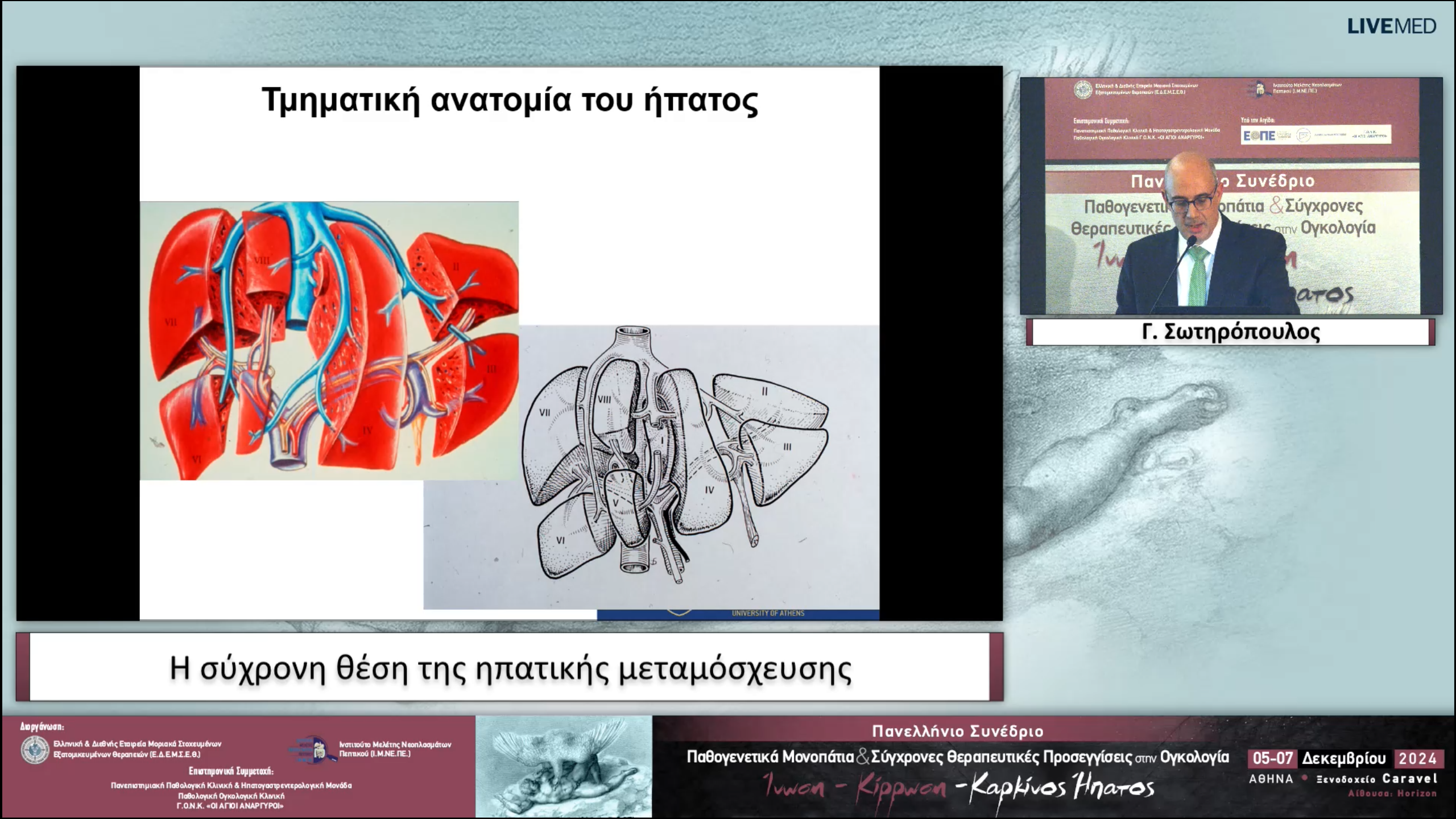 31 Γ. Σωτηρόπουλος - Η σύχρονη θέση της ηπατικής μεταμόσχευσης 