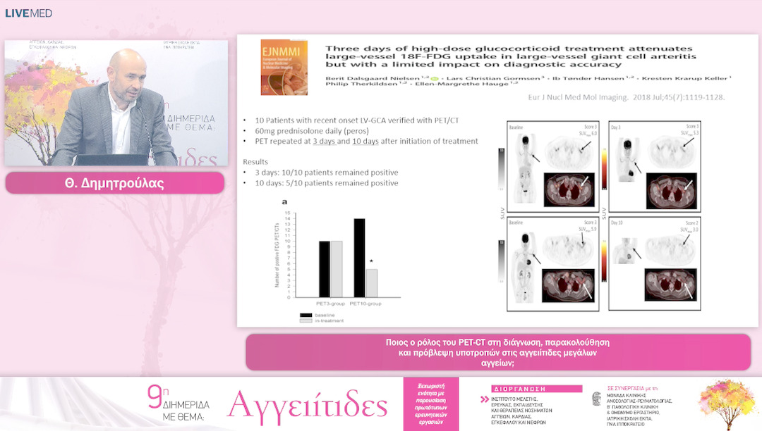 42 Θ. Δημητρούλας - Ποιος ο ρόλος του PET-CT στη διάγνωση, παρακολούθηση και πρόβλεψη υποτροπών στις αγγειίτιδες μεγάλων αγγείων; 