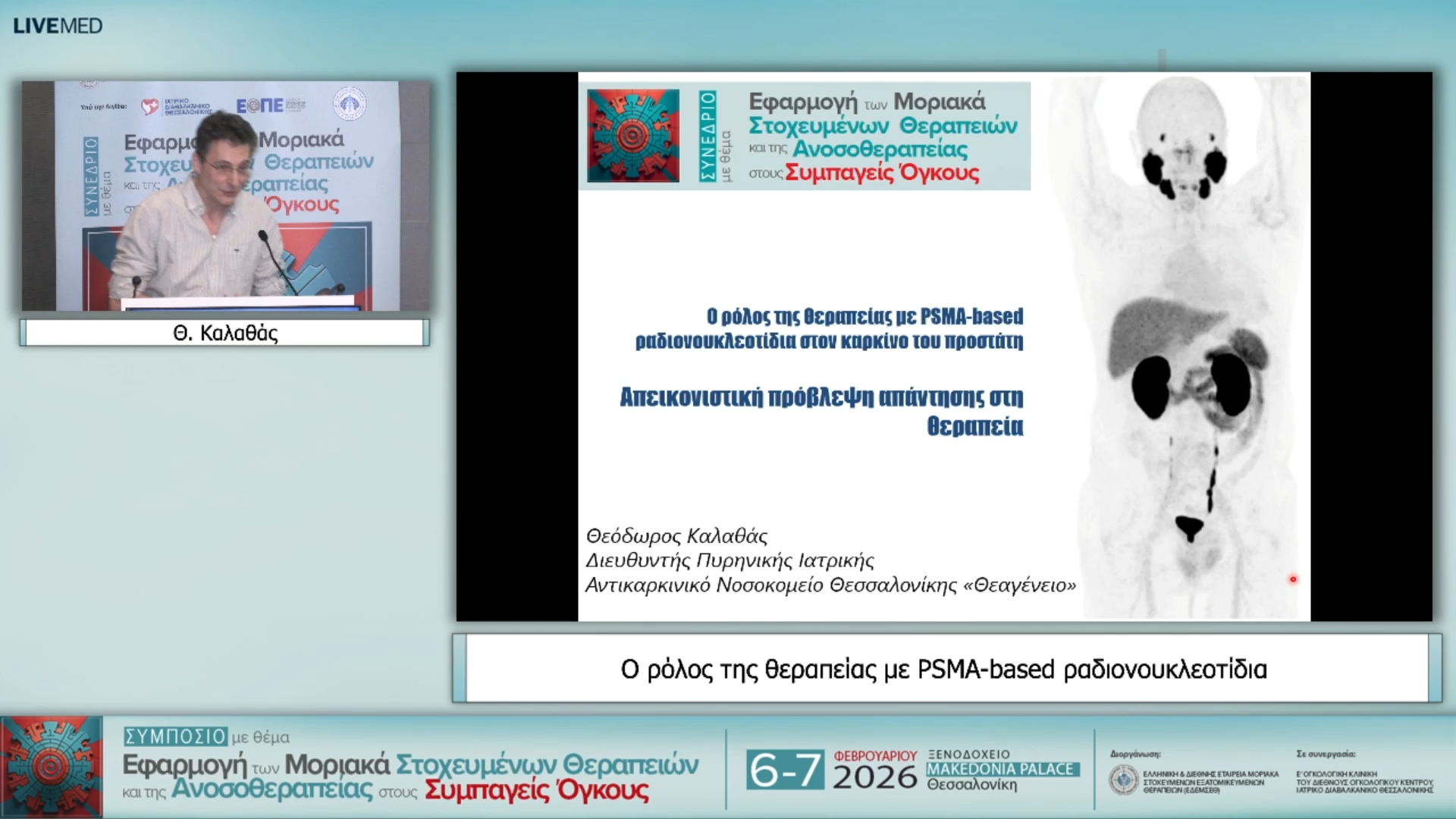 42 Θ. Καλαθάς - Ο ρόλος της θεραπείας µε PSMA-based ραδιονουκλεοτίδια
