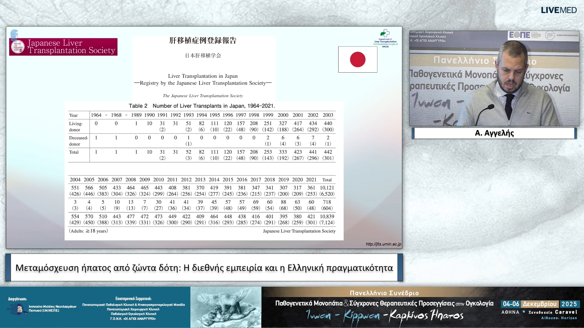 29 Α. Αγγελής - Μεταμόσχευση ήπατος από ζώντα δότη: H διεθνής εμπειρία και η Ελληνική πραγματικότητα