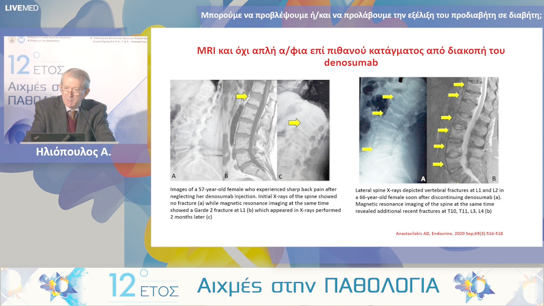 19 Hλιόπουλος Α. - Τι νεότερο στη θεραπεία της οστεοπόρωσης; 