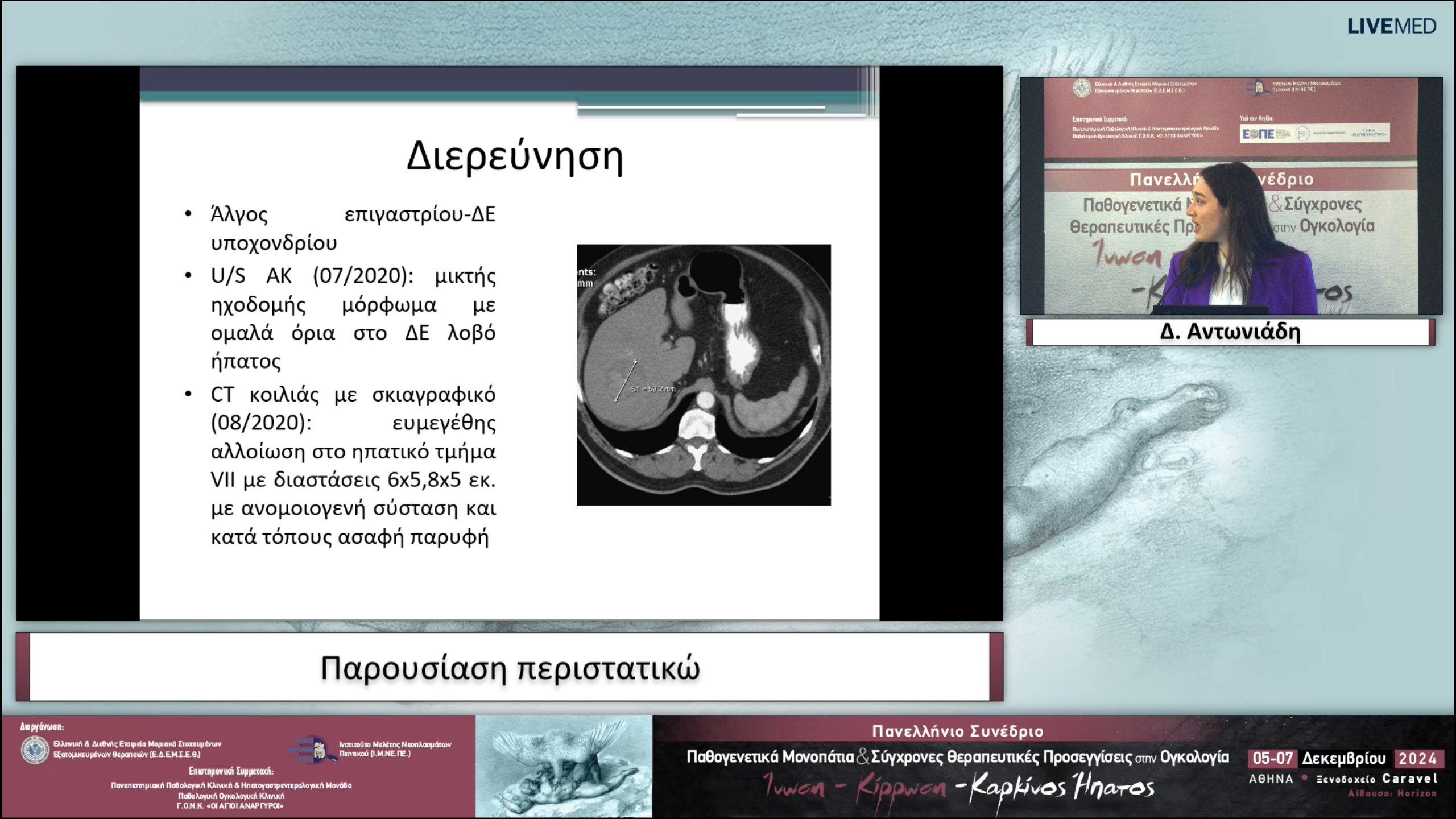 37 Δ. Αντωνιάδη - Παρουσίαση περιστατικών